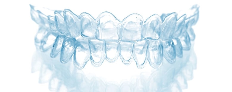 Переваги елайнерів Invisalign