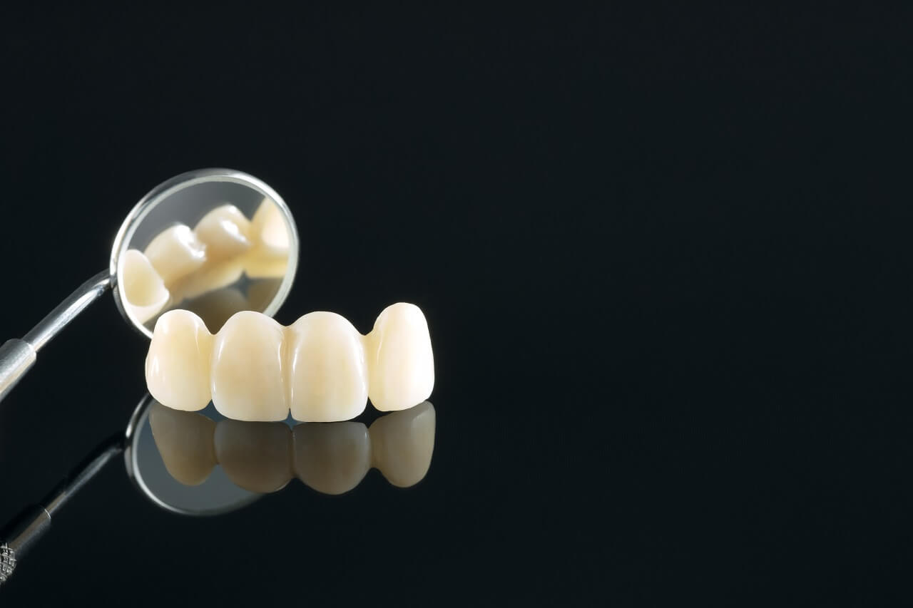 Коли збереження зуба під коронкою стає найкращим рішенням